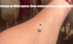 Erzincan’da KKKA Alarmı: Kene Temasına Karşı Alınması Gereken Hayati Önlemler