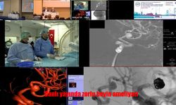 Girişimsel Nöroradyolojide Türk Bilimi Zirvede