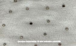 Çocuğun boğazından 19 adet mıknatıs çıkartıldı