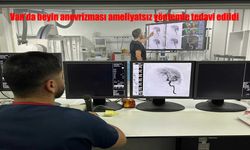 Van’da Beyin Anevrizması Ameliyatsız Yöntemle Tedavi Edildi