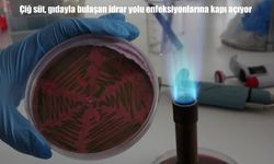 Çiğ süt, gıdayla bulaşan idrar yolu enfeksiyonlarına kapı açıyor