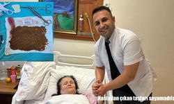 70 yaşındaki kadının safra kesesinden 20 binin üzerinde taş çıktı