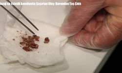 Elazığ’da Estetik Ameliyatta Şaşırtan Olay: Burundan Taş Çıktı