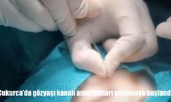 Çukurca'da gözyaşı kanalı ameliyatları yapılmaya başlandı