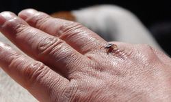 Erzincan’da Kene Alarmı: KKKA Riski Artıyor, Vatandaşlara Kritik Uyarılar