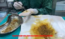 Bingöl’de Şaşırtan Vaka: Safra Kesesinden 2 Bin 67 Taş Çıkarıldı