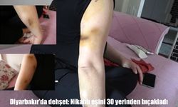 Diyarbakır’da dehşet: Eşini 30 yerinden bıçakladı