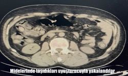 Malatya'da uyuşturucu operasyonu: Midelerinden 169 kapsül uyuşturucu çıktı