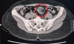 Kars’ta İran uyruklu 2 şüphelinin üzerinden 307 gram metamfetamin çıktı