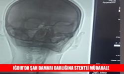 Iğdır’da şah damarı darlığına başarılı müdahale