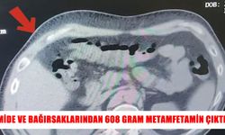 Otobüste yakalandı, mide ve bağırsaklarından metamfetamin çıktı