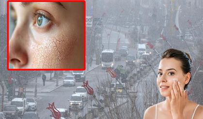 Muş’un sert kışlarına karşı cilt bakımı önerileri