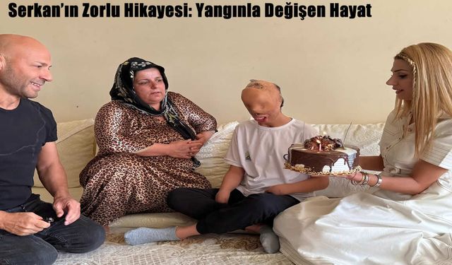 Serkan’ın Zorlu Hikayesi: Yangınla Değişen Hayat
