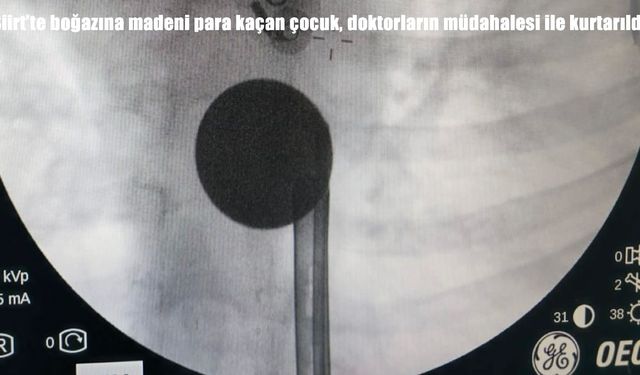 Siirt’te boğazına madeni para kaçan çocuk kurtarıldı