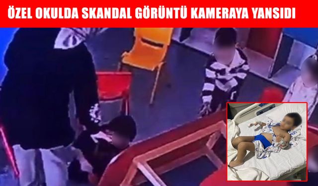 Özel okulda skandal görüntü kameraya yansıdı: Çocuğun parmakları bu hale geldi