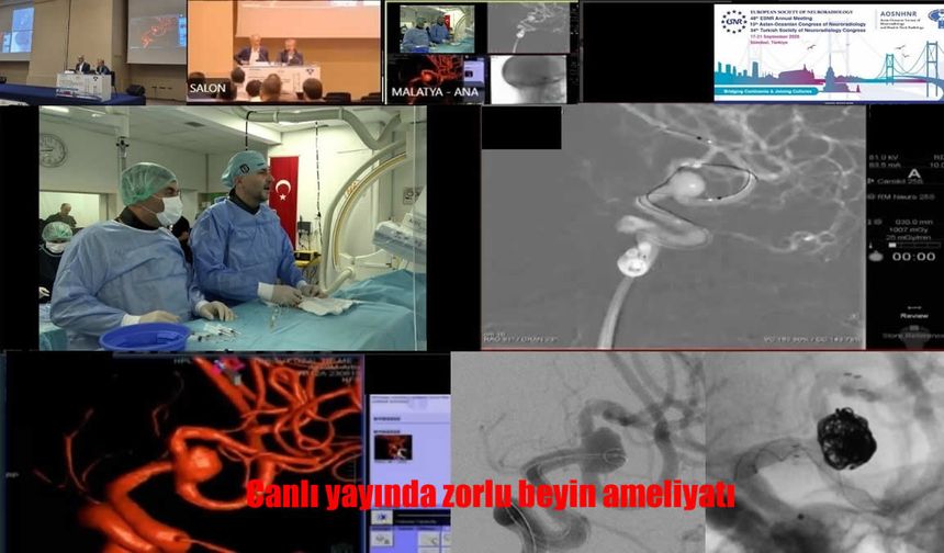 Girişimsel Nöroradyolojide Türk Bilimi Zirvede