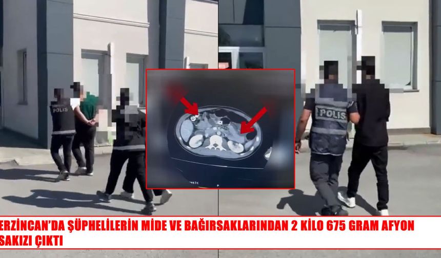 Erzincan’da uyuşturucu operasyonu: Şüphelilerin mide ve bağırsaklarından 2 kilo 675 gram afyon sakızı çıkt